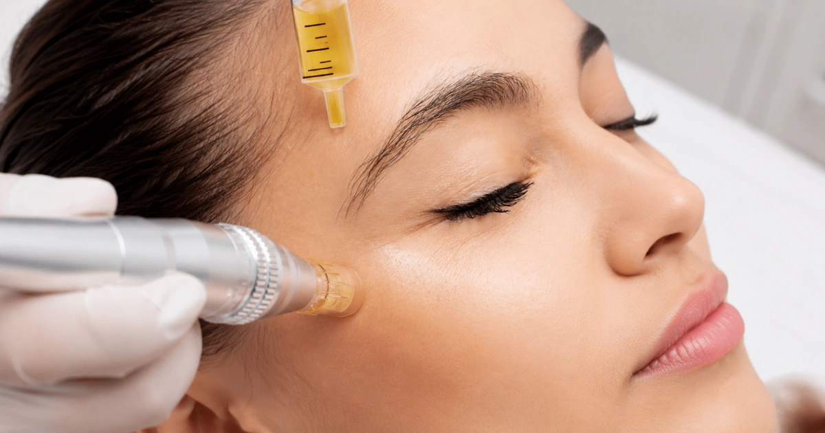 Rejuvenecimiento facial con PDRN de salmón en Jinotepe, Carazo